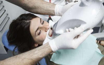 Excepciones en el blanqueamiento dental