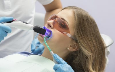 Dudas comunes sobre el blanqueamiento dental