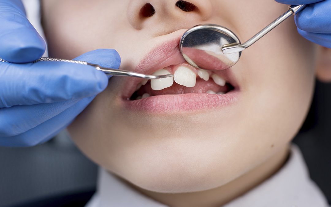 ¿A qué edad se debe empezar un tratamiento de ortodoncia?
