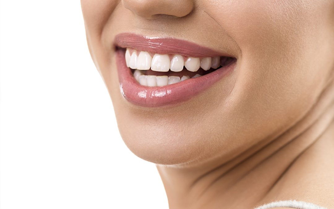 ¿Reconstrucciones de composite, carillas o coronas dentales?